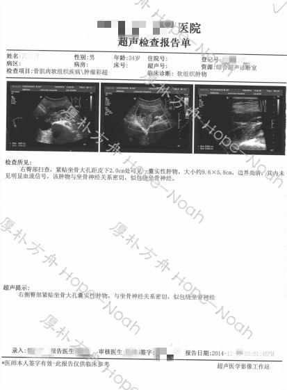 梭形细胞肉瘤治疗