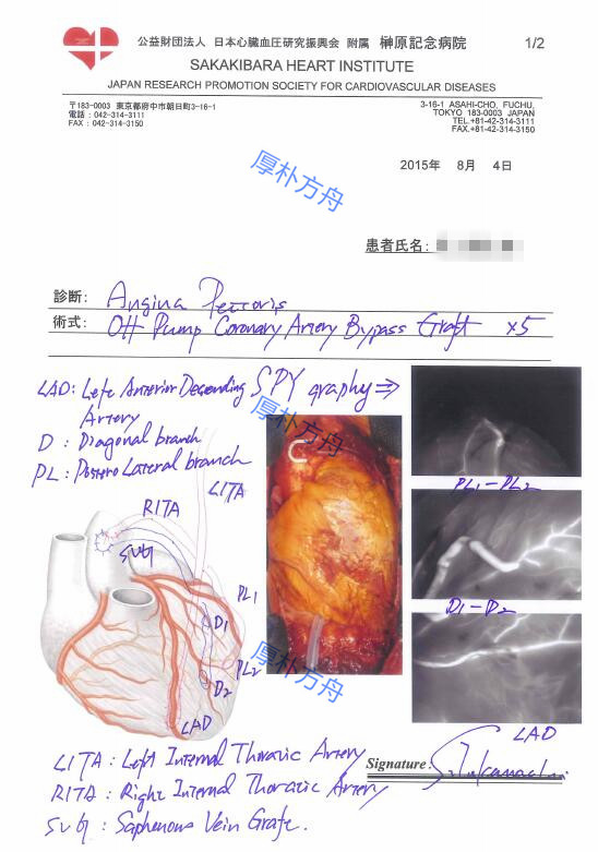 冠心病搭桥手术方案