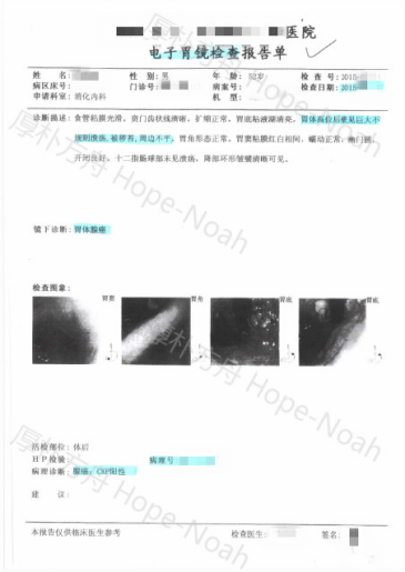 胃癌检查报告