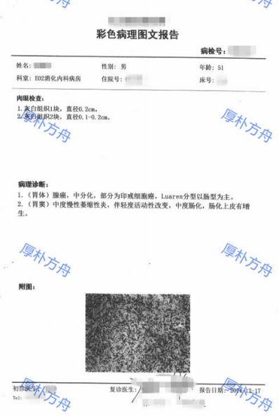 胃癌检查报告