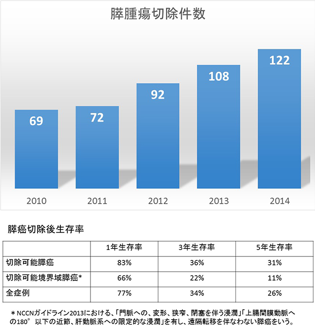 胰腺癌治疗