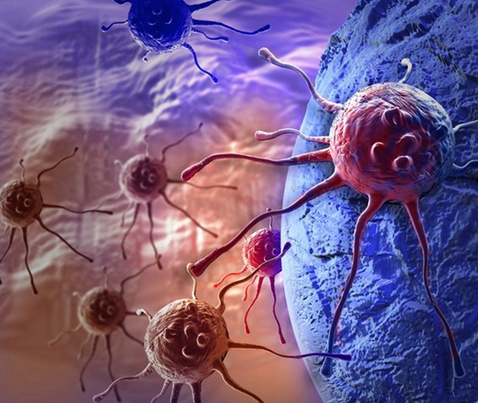 美国治疗小细胞癌:免疫疗法首次突破