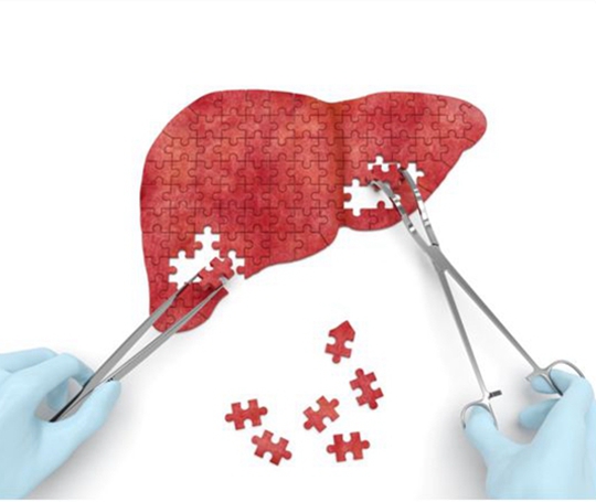 肝癌发病率高,出国治疗肝癌有哪些方法?