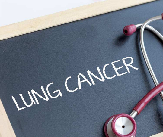 国外治疗小细胞肺癌