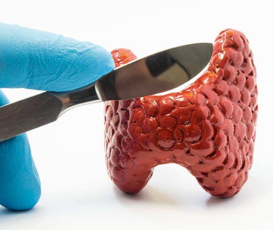 日本如何治疗甲状腺结节?甲状腺结节如何预防