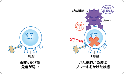 日本免疫疗法方法治疗癌症的一般资讯