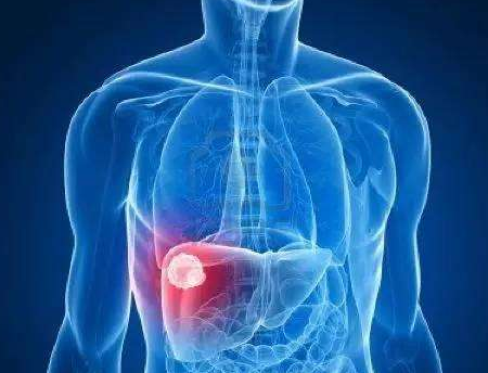 肝癌晚期一般是怎样的发展过程