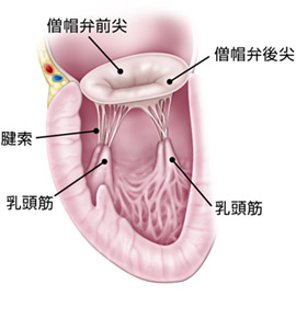 心脏瓣膜病