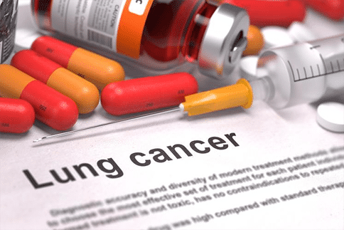 肺癌基因发展关键