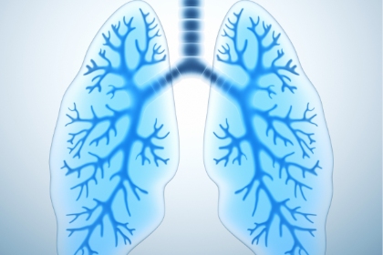 出国看病：肺纤维化疾病如何治疗？调节白介素-11或可改善相关症状