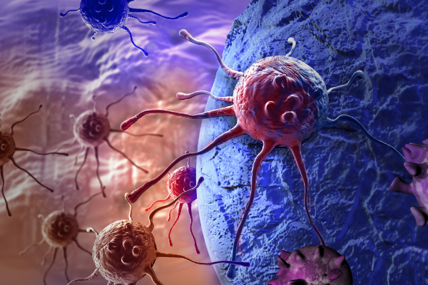 研究发现儿童肾癌的新机制，或为儿童肾癌治疗提供新策略