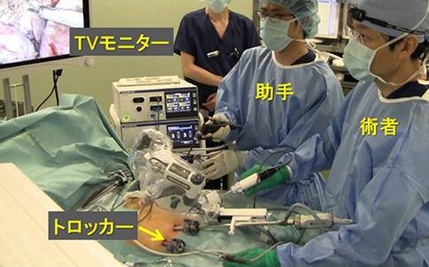 日本腹腔镜手术治疗直肠癌