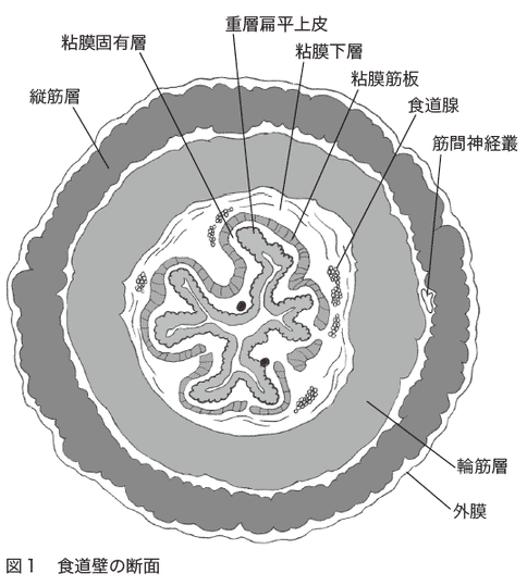 食道癌治疗技术