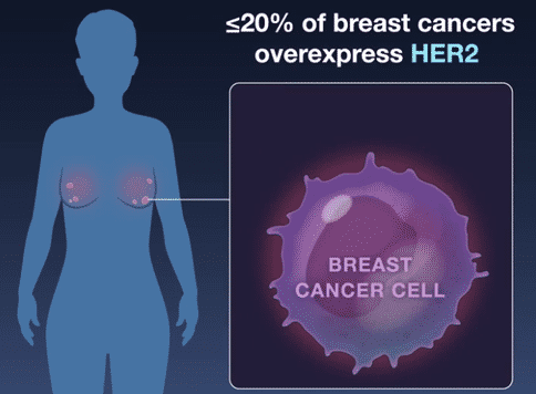 乳腺癌治疗