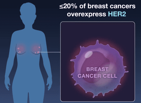 乳腺癌就医