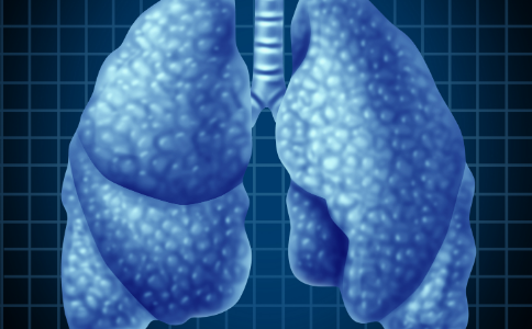 肺癌基因治疗