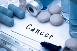 晚期肝癌治疗方法
