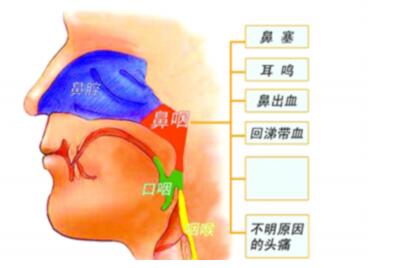 鼻窦癌就医