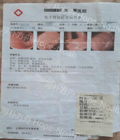 在前年因偶感胃胀到当地医院进行胃镜检查,确诊罹患慢性萎缩性胃炎