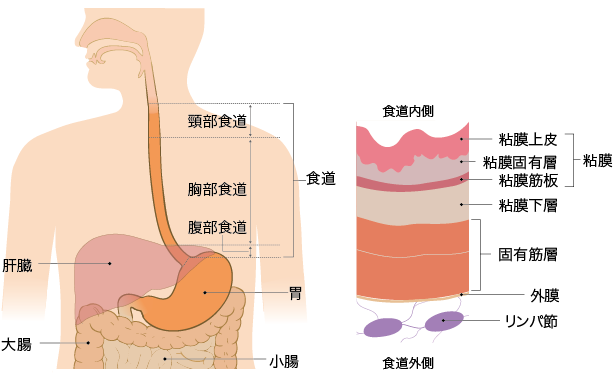 日本食管癌治疗