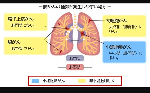 日本治疗肺癌前沿方法
