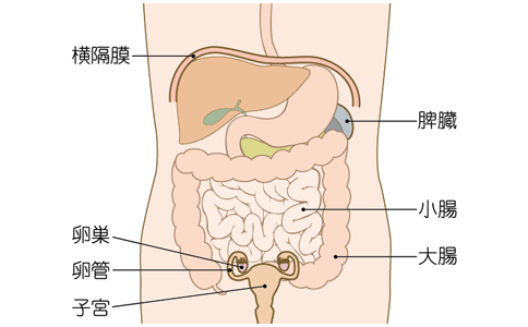 日本卵巢癌治疗方法