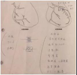 日本治疗冠心病