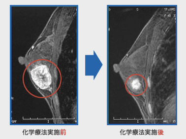 日本治疗乳腺癌医院排名