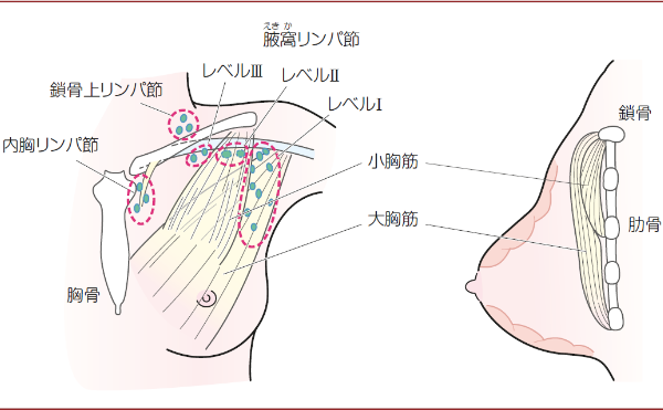 日本乳腺癌治疗