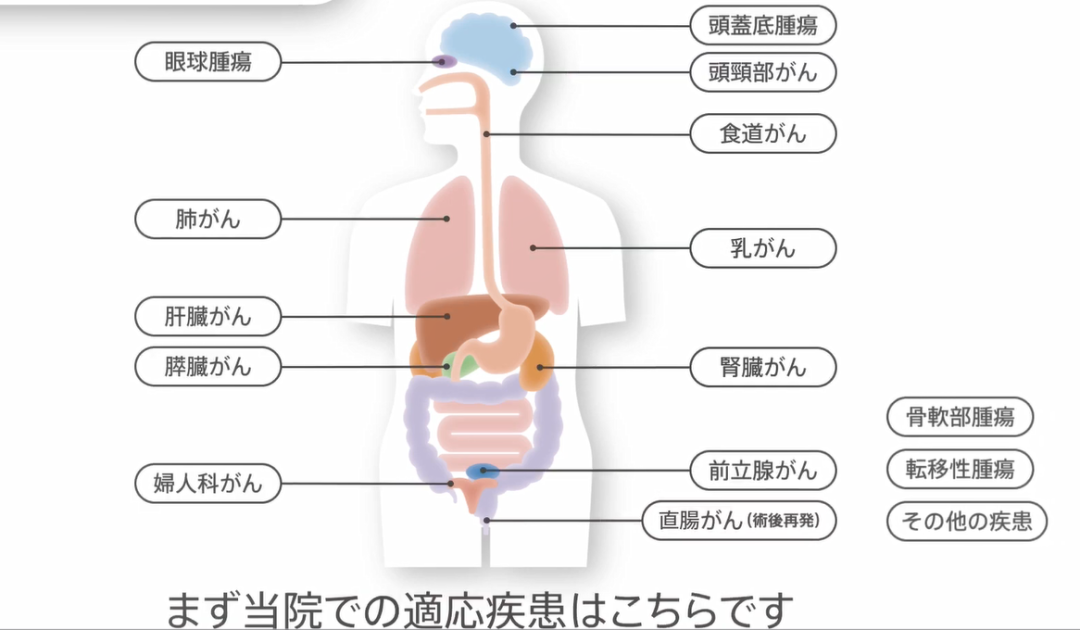 日本重离子治疗