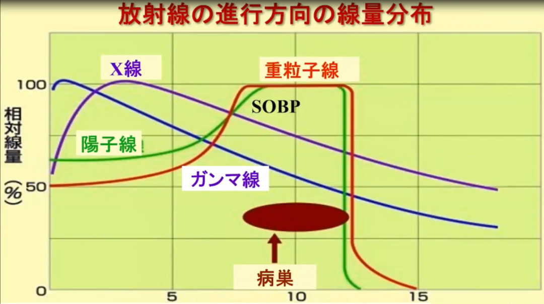 日本重离子治疗