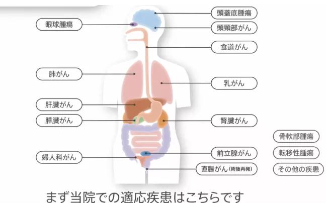 质子重离子治疗