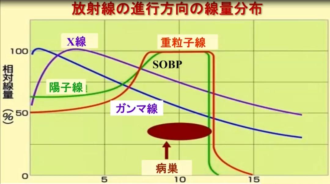 质子重离子治疗