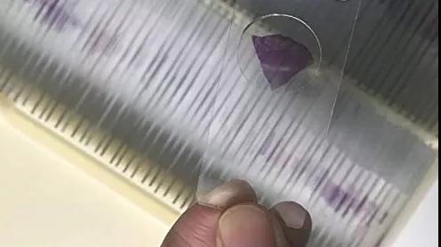 病理诊断