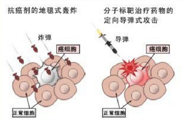 靶向治疗