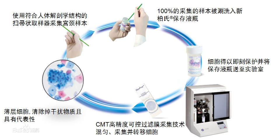 TCT检查流程