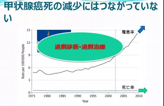 微小甲状腺癌的治疗