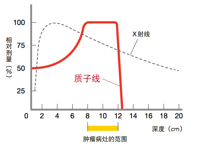 质子治疗