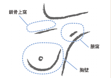 乳腺癌医院