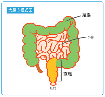 直肠癌