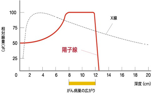 儿童肿瘤质子治疗医院