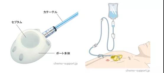 癌症化疗专家