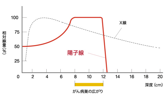 质子重离子原理