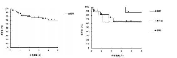 鼻咽癌质子治疗