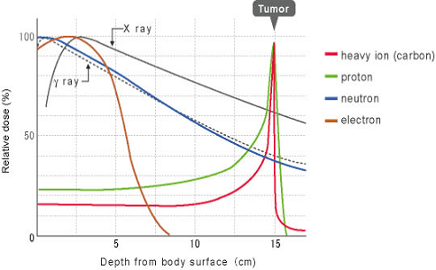 日本重离子治疗肿瘤