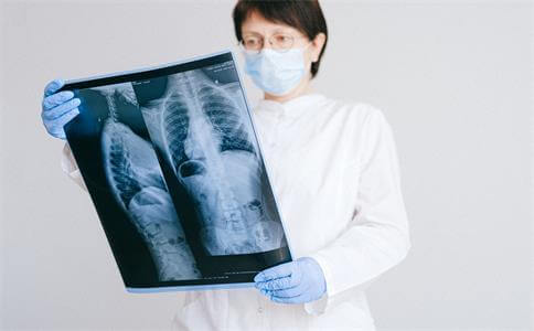 肺癌影像学检查