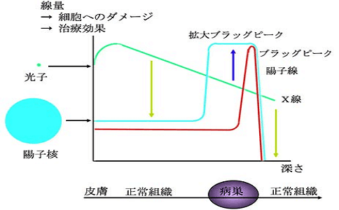 质子重离子治疗早期肺癌