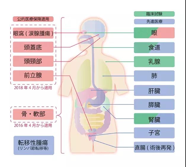 日本重离子治疗医院