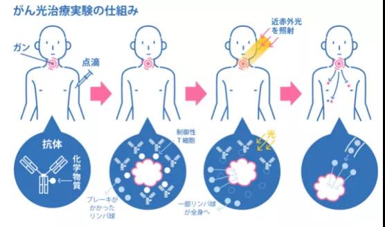 光免疫治疗癌症