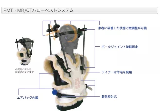 脊索瘤日本手术